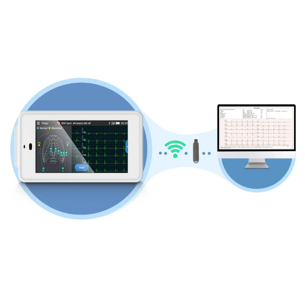 12-Lead Pocket ECG Machine