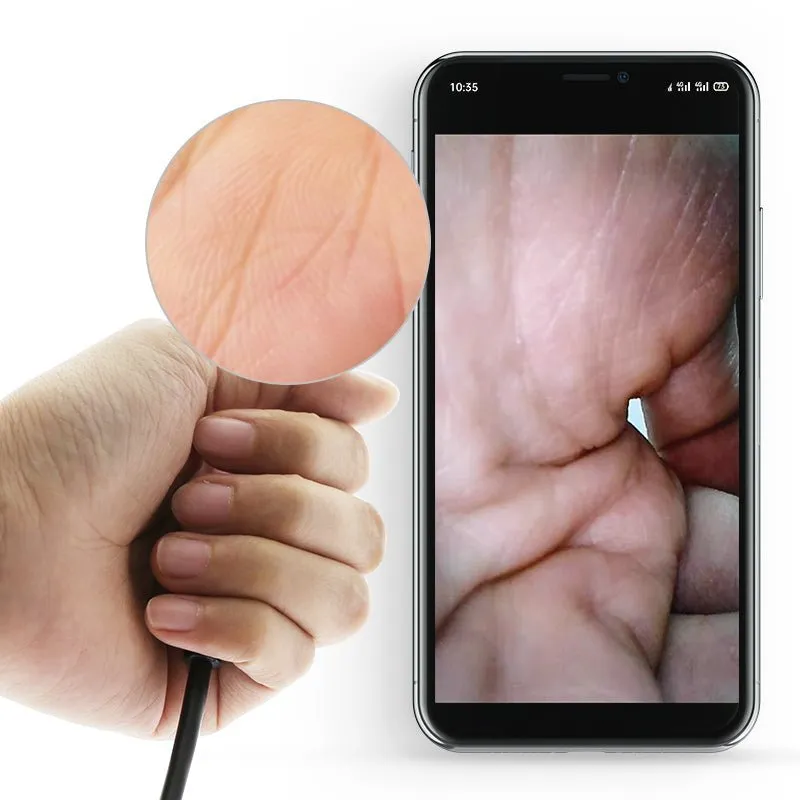 Vagina / Anal Camera - Dual lighted Lenses / Endoscope